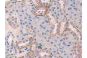 Detection of LGMN in Mouse Kidney Tissue using Polyclonal Antibody to Legumain (LGMN)