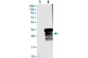 Western blot analysis of Lane 1: Negative control (vector only transfected HEK293T lysate), Lane 2: Over-expression Lysate (Co-expressed with a C-terminal myc-DDK tag (~3. (RRP36 anticorps)