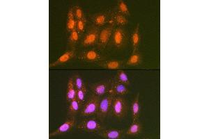 Immunofluorescence analysis of C6 cells using LTH Rabbit mAb (ABIN7268244) at dilution of 1:100 (40x lens). (LTA4H anticorps)