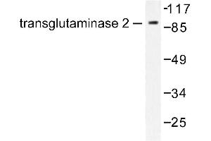 Image no. 1 for anti-Transglutaminase 2 (C Polypeptide, Protein-Glutamine-gamma-Glutamyltransferase) (TGM2) antibody (ABIN271855) (Transglutaminase 2 anticorps)