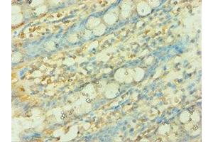 Immunohistochemistry of paraffin-embedded human colon tissue using ABIN7149303 at dilution of 1:100 (CISH anticorps  (AA 1-257))