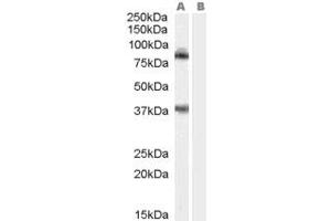 ABIN184941 staining (1ug/ml) of Mouse Brain (RIPA buffer, 35ug total protein per lane). (TRIM3 anticorps  (N-Term))
