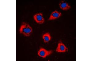 Immunofluorescent analysis of Caspase 9 staining in NIH3T3 cells. (Caspase 9 anticorps  (Center))