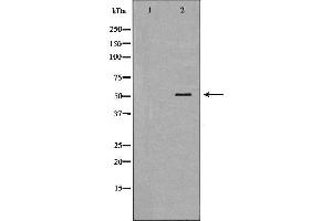 Western blot analysis of Hepg2 whole cell lysates, using BPI Antibody.
