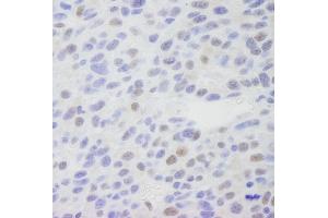 Immunohistochemistry (IHC) image for anti-Mediator Complex Subunit 1 (MED1) (C-Term) antibody (ABIN7448659) (MED1 anticorps  (C-Term))