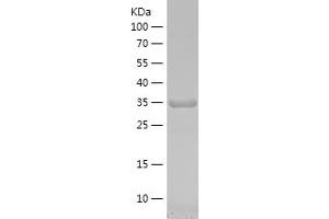 Western Blotting (WB) image for N-Acetylgalactosaminidase, alpha (NAGA) (AA 210-321) protein (His-IF2DI Tag) (ABIN7124083)