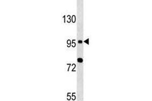 TLR6 antibody western blot analysis in MCF-7 lysate