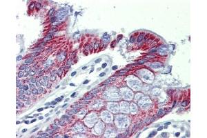 ACAA1 antibody was used for immunohistochemistry at a concentration of 4-8 ug/ml. (ACAA1 anticorps)