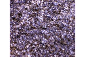 IHC analysis of IL7 using anti-IL7 antibody (ABIN3044526). (IL-7 anticorps  (AA 26-154))