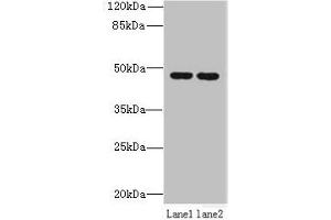Western blot All lanes: ZDHHC6 antibody at 0. (ZDHHC6 anticorps  (AA 227-409))