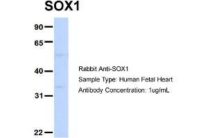 Host: Rabbit Target Name: SOX1 Sample Type: Human Fetal Heart Antibody Dilution: 1.