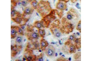IHC-P analysis of Liver tissue, with DAB staining. (Orosomucoid 2 anticorps  (AA 19-207))