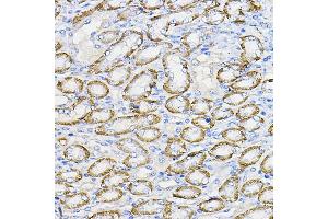 Immunohistochemistry of paraffin-embedded mouse kidney using NUBP1 Rabbit pAb (ABIN7269062) at dilution of 1:100 (40x lens). (NUBP1 anticorps  (AA 201-320))