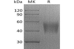 Western Blotting (WB) image for V-Set Domain Containing T Cell Activation Inhibitor 1 (VTCN1) (Active) protein (His tag) (ABIN7321009)