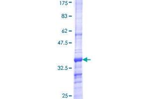 Image no. 1 for Sodium Channel, Voltage-Gated, Type II, alpha Subunit (SCN2A) (AA 273-362) protein (GST tag) (ABIN1319275)