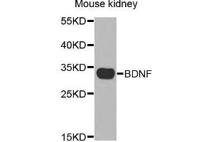 anti-Brain-Derived Neurotrophic Factor (BDNF) (AA 20-247) antibody