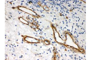 Immunohistochemistry (Paraffin-embedded Sections) (IHC (p)) image for anti-Heparan Sulfate Proteoglycan 2 (HSPG2) (AA 524-701) antibody (ABIN3042466)