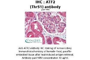 Image no. 1 for anti-Activating Transcription Factor 2 (ATF2) antibody (ABIN1732006) (ATF2 anticorps)