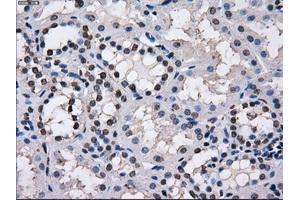 Immunohistochemical staining of paraffin-embedded endometrium tissue using anti-TTLL12mouse monoclonal antibody. (TTLL12 anticorps)