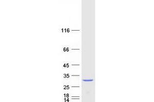 Validation with Western Blot