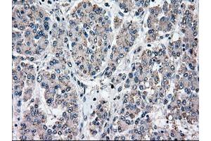 Image no. 3 for anti-Mitogen-Activated Protein Kinase Kinase 4 (MAP2K4) antibody (ABIN1499481)