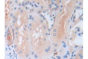 Detection of CAP3 in Human Kidney Tissue using Polyclonal Antibody to Cytoplasmic Antiproteinase 3 (CAP3)