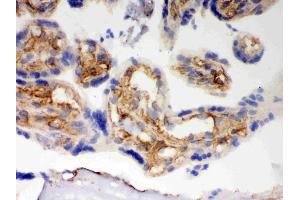 IHC analysis of BAK using anti-BAK antibody .