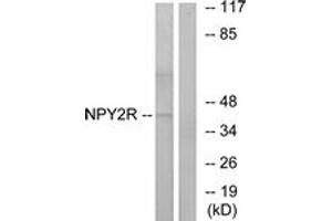 Western blot analysis of extracts from HepG2 cells, using NPY2R Antibody. (NPY2R anticorps  (AA 1-50))