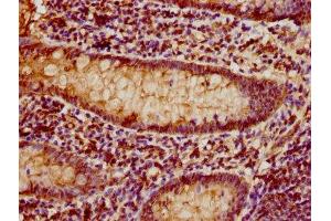 IHC image of ABIN7171386 diluted at 1:80 and staining in paraffin-embedded human appendix tissue performed on a Leica BondTM system.