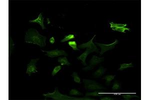 Immunofluorescence of monoclonal antibody to NTRK3 on HeLa cell. (NTRK3 anticorps  (AA 41-160))