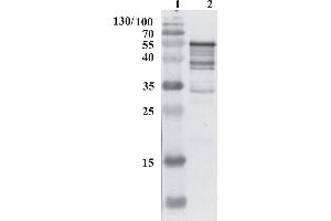 Western Blot testing of anti-HCV NS5B protein using chimeric anti-HCV NS5B antibody 9A2. (HCV 1b NS5B anticorps  (AA 111-130))