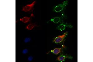 ABIN6262617 and ABIN6268893 staining HepG2 by IF/ICC. (Integrin beta 4 anticorps  (C-Term))