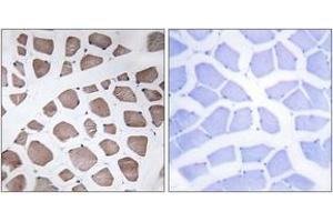 Immunohistochemistry analysis of paraffin-embedded human skeletal muscle tissue, using MRPS18C Antibody.