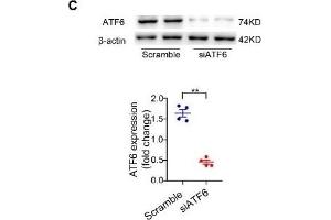 BCAA increase PPAR-α expression in a GCN2/ATF6 pathway-dependent manner. (beta Actin anticorps)