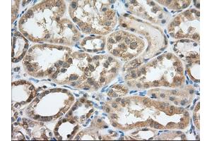 Image no. 1 for anti-Transforming, Acidic Coiled-Coil Containing Protein 3 (TACC3) antibody (ABIN1498098) (TACC3 anticorps)