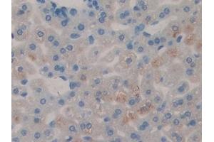 Detection of LEI in Mouse Liver Tissue using Polyclonal Antibody to Leukocyte Elastase Inhibitor (LEI)