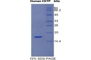 SDS-PAGE analysis of Human CETP Protein. (CETP Protéine)
