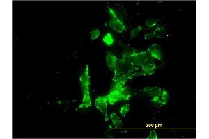 Immunofluorescence of monoclonal antibody to CENPK on HepG2 cell.