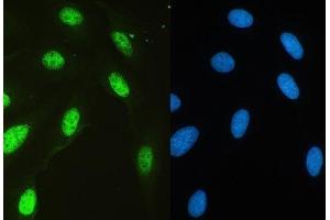 IF analysis of HAUSP/USP7 using anti-HAUSP/USP7 antibody (ABIN5693267). (USP7 anticorps  (AA 258-483))