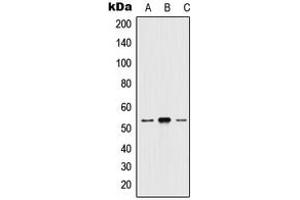 Western blot analysis of 5-HT2A expression in HEK293T (A), mouse brain (B), H9C2 (C) whole cell lysates. (HTR2A anticorps  (N-Term))