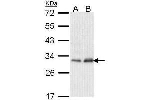 WB Image Sample (30 ug of whole cell lysate) A: Hela B: Hep G2 , 12% SDS PAGE antibody diluted at 1:1000 (PMM2 anticorps)