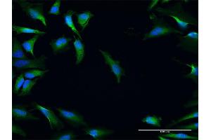 Immunofluorescence of purified MaxPab antibody to NRBF2 on HeLa cell. (NRBF2 anticorps  (AA 1-287))