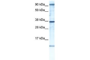 AKAP7 antibody used at 1 ug/ml to detect target protein. (AKAP7 anticorps)