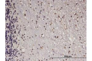 Immunoperoxidase of monoclonal antibody to ATF5 on formalin-fixed paraffin-embedded human cerebellum.