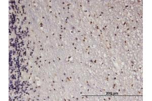 Immunoperoxidase of monoclonal antibody to ATF5 on formalin-fixed paraffin-embedded human cerebellum.