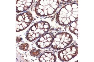 Immunohistochemistry of paraffin-embedded human colon using CC2D1A Rabbit mAb (ABIN7266430) at dilution of 1:100 (40x lens).