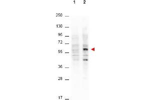 Western Blotting (WB) image for anti-V-Akt Murine Thymoma Viral Oncogene Homolog 1 (AKT1) (Thr308) antibody (ABIN400786) (AKT1 anticorps  (Thr308))