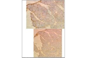 Immunohistochemistry (IHC) image for anti-Microtubule-Associated Protein 1 Light Chain 3 alpha (MAP1LC3A) antibody (ABIN5551132)