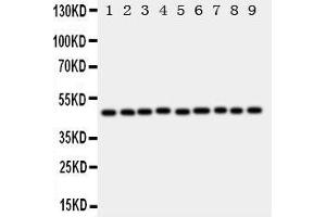 Western Blotting (WB) image for anti-E2F Transcription Factor 2 (E2F2) (AA 422-427), (C-Term) antibody (ABIN3043044)