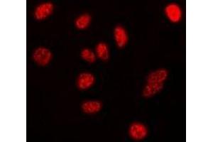 Immunofluorescent analysis of Nucleophosmin staining in HeLa cells.